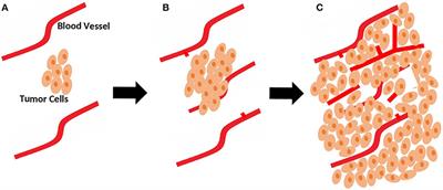 Resistance Mechanisms to Anti-angiogenic Therapies in Cancer